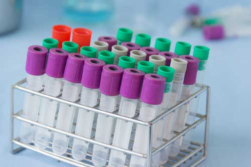 Pathology Sample Tracking